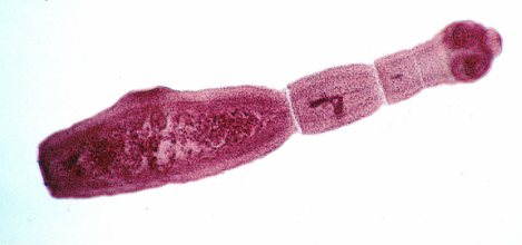 Parazitológiai (Trichinella, Echinococcus) projekt